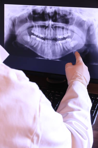 Best Emergency Wisdom Teeth Removal in Gibsonville, NC
